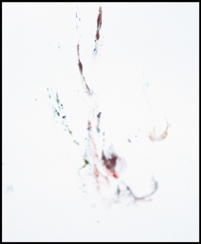 sudden_death_10